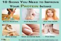 What are the symptoms of low protein?